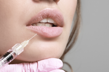 Ботулінотерапія