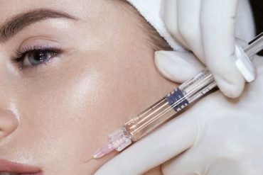 Що таке карбокситерапія?