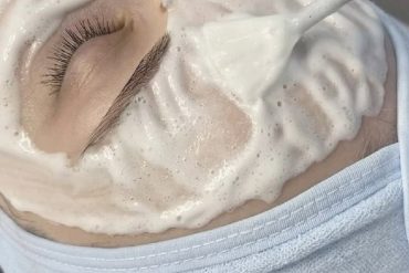 Що спільного між мезотерапією та біоревіталізацією?